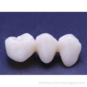 Porcelain Teeth Wieland Zenostar